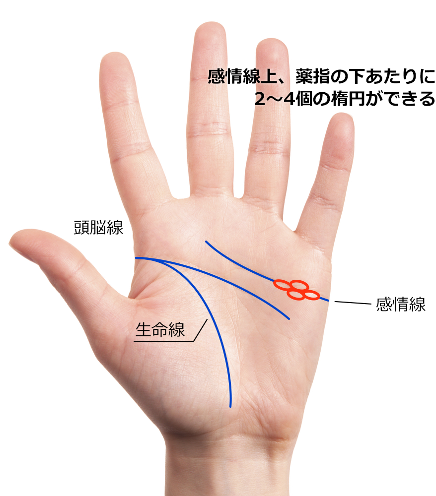 感情線上、薬指の下あたりに2～4個の楕円ができる手相