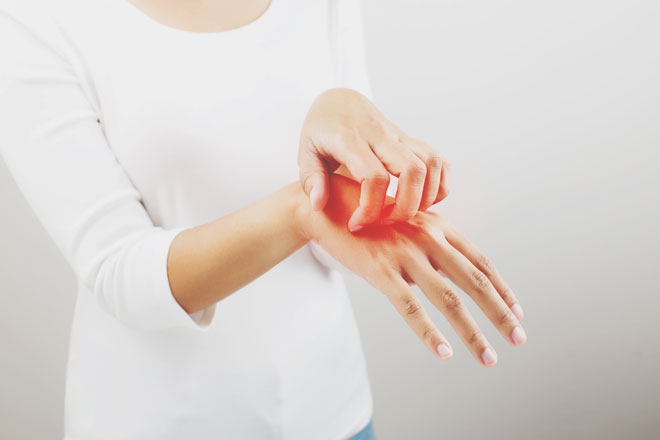 【夢占い】やけどの夢は金運アップ！　ケガの夢が暗示することとは？