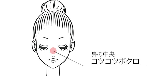 鼻の中央にある「コツコツボクロ」